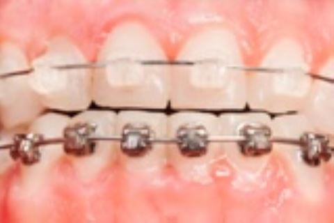 خدمات ارتودنسی دندان