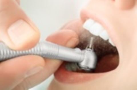 خدمات ترمیم دندان